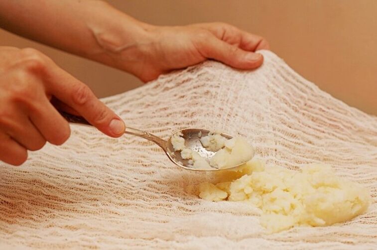 potato dressing for cervical osteochondrosis