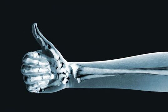 X-rays can help diagnose joint pain