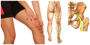 back pain and leg treatment