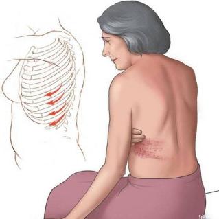 sore ribs from the back causes