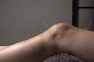Acupuncture promotes joint tissue regeneration